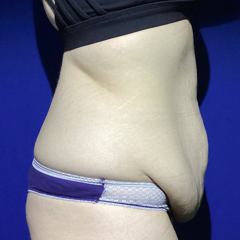 Before treatment