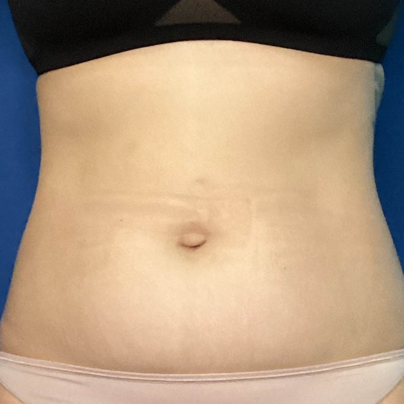 After treatment