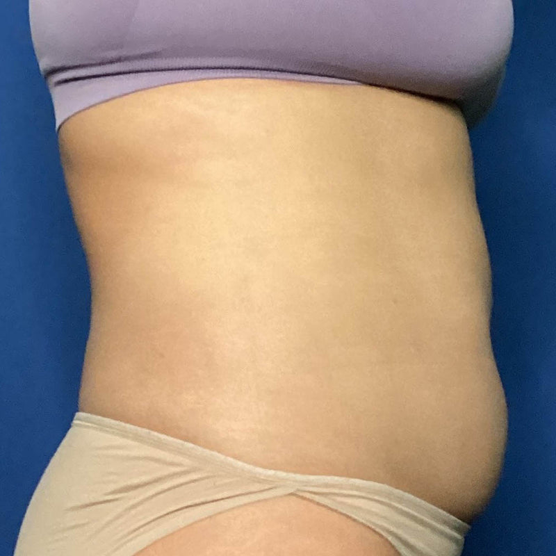 Before treatment