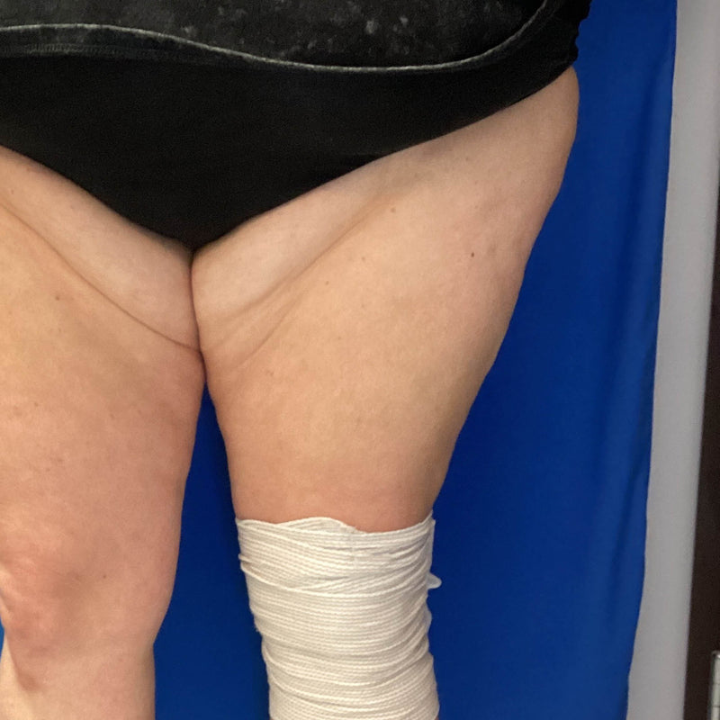 After treatment