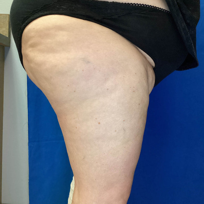 After treatment