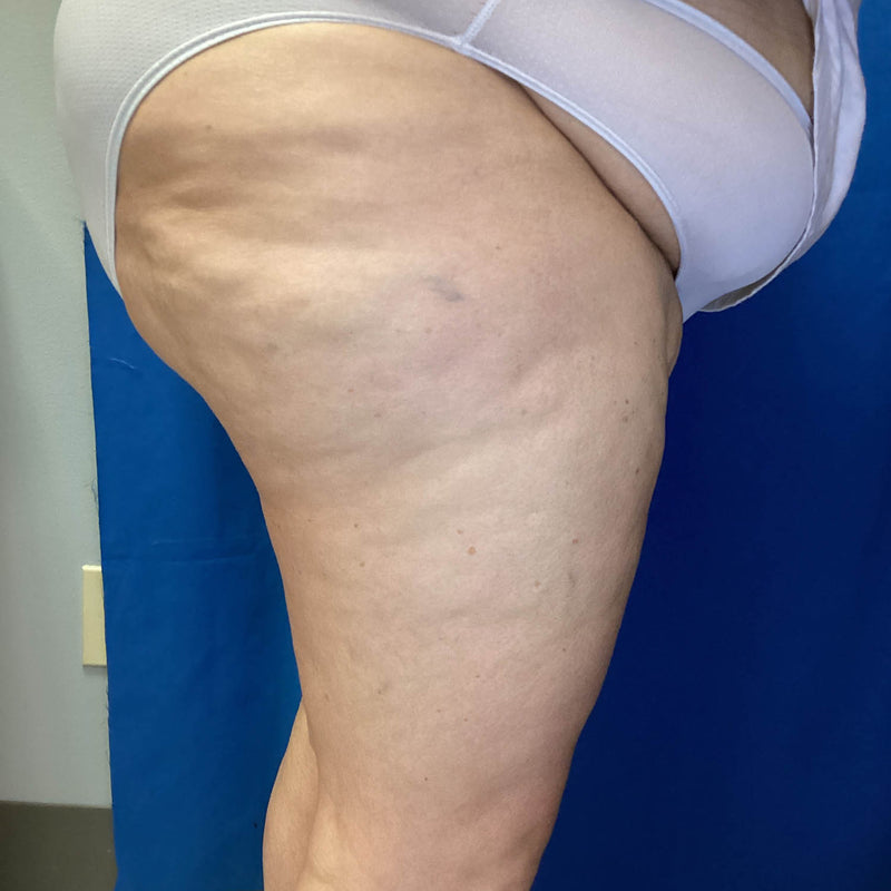 Before treatment