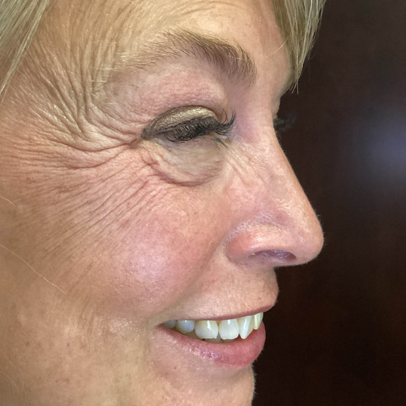 Before treatment