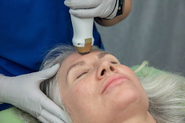 Fractional Resurfacing