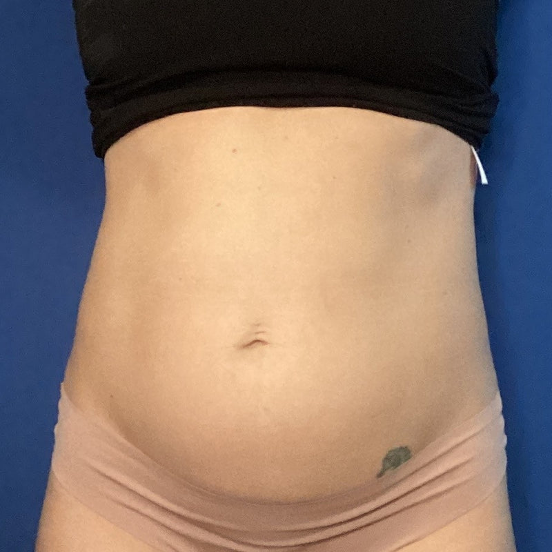 Before treatment