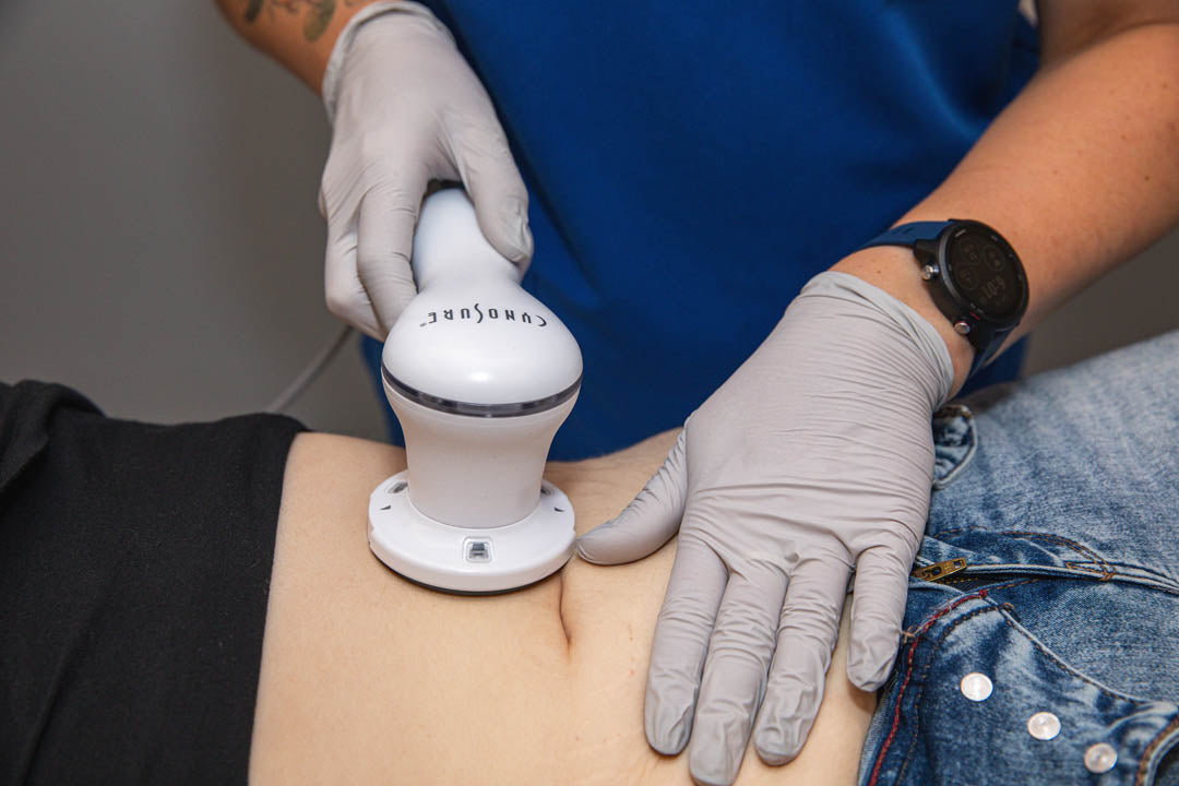 Tempsure Skin Tightening treatment on patients abdomen.